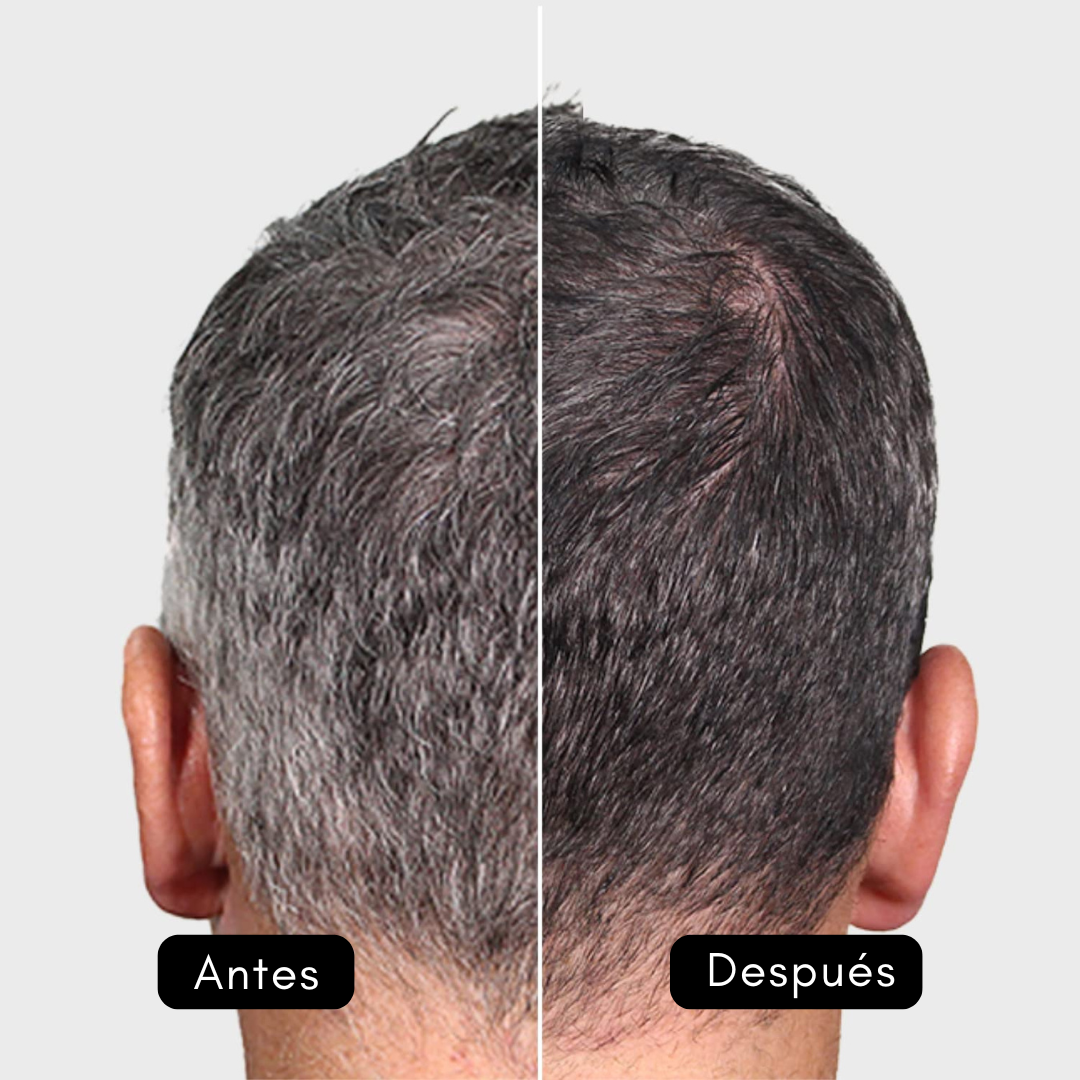 SHOUWU QUAM BLACK™ - EL SHAMPOO ORGÁNICO 100% REJUVENECEDOR